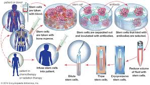 Bone Marrow Transplant